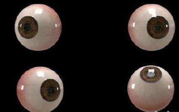 世界首個(gè)3D人工眼球問(wèn)世，數百萬(wàn)人將重見(jiàn)光明